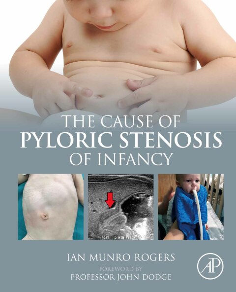 Cover image for book The Cause of Pyloric Stenosis of Infancy