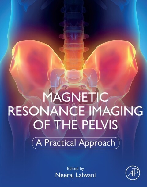 Cover image for book Magnetic Resonance Imaging of The Pelvis