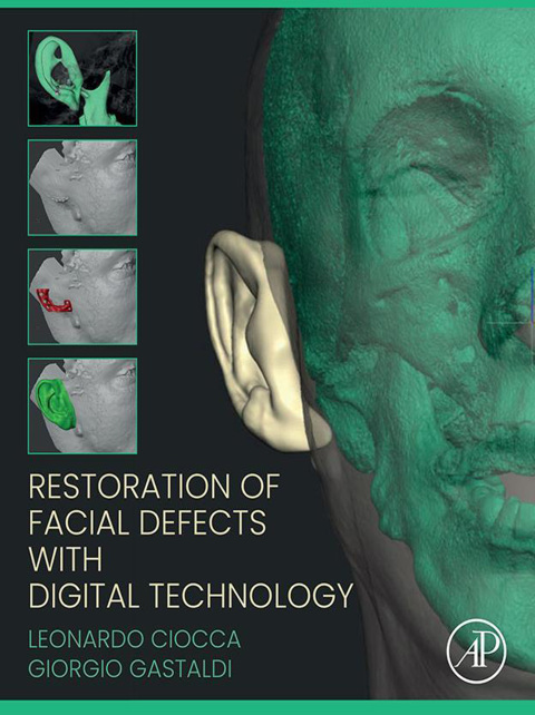 Cover image for book Restoration of Facial Defects with Digital Technology