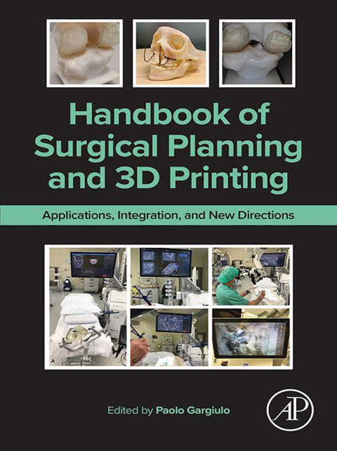 Cover image for book Handbook of Surgical Planning and 3D Printing