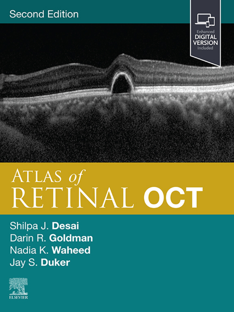 Cover image for book Atlas of Retinal OCT