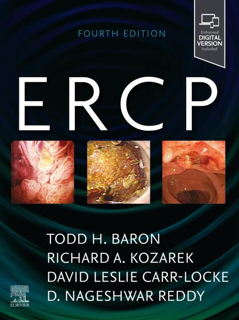 ERCP 