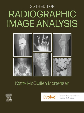 Radiographic Image Analysis
