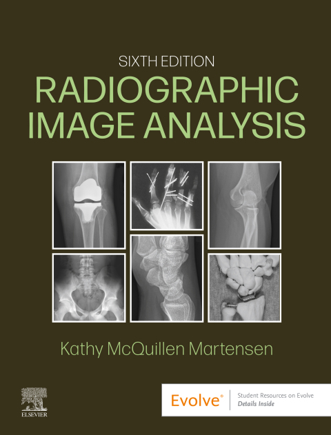 Cover image for book Radiographic Image Analysis