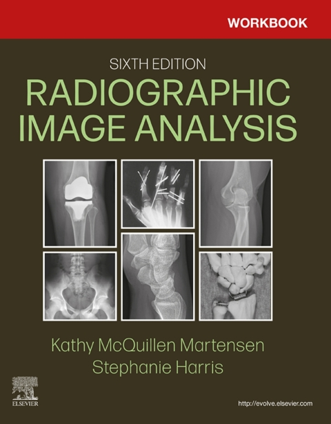 Cover image for book Workbook for Radiographic Image Analysis
