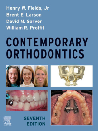 Contemporary Orthodontics