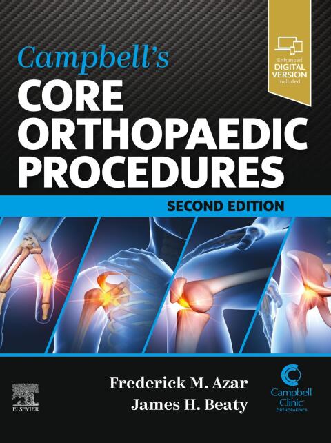 Campbell's Core Orthopaedic Procedures 