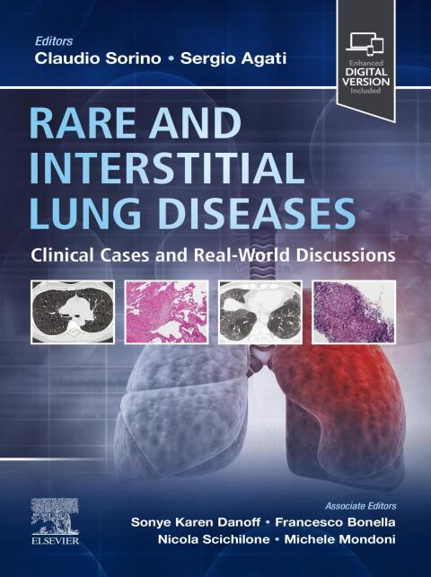 Rare and Interstitial Lung Diseases 