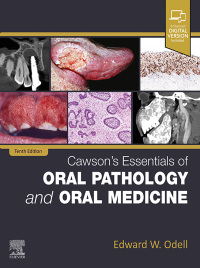 Cawson's Essentials of Oral Pathology and Oral Medicine