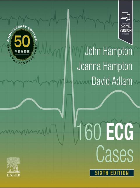 Cover image for book 160 ECG Cases