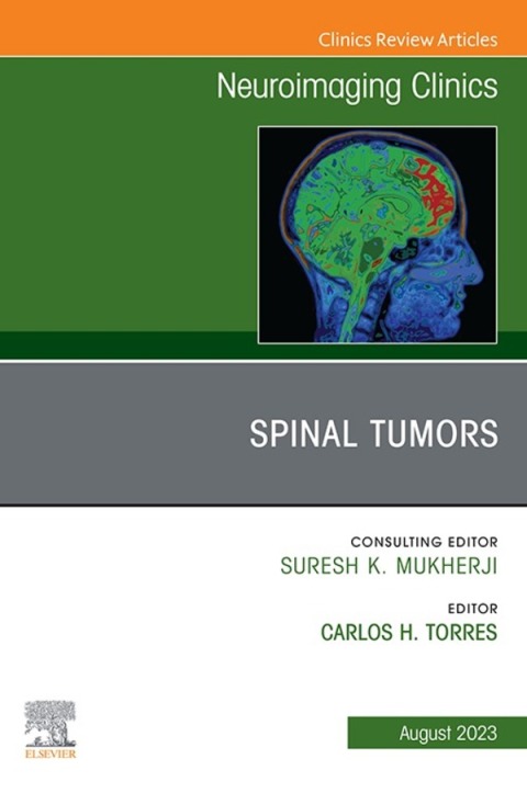 Cover image for book Spinal Tumors, An Issue of Neuroimaging Clinics of North America