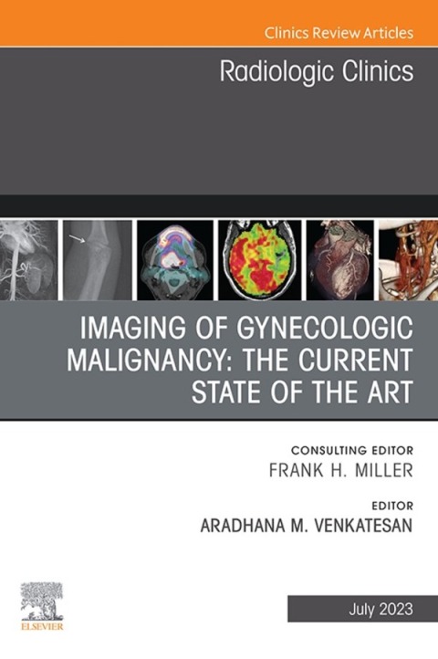 Cover image for book Imaging of Gynecologic Malignancy: The Current State of the Art, An Issue of Radiologic Clinics of North America