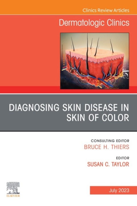 Cover image for book Diagnosing Skin Disease in Skin of Color, An Issue of Dermatologic Clinics