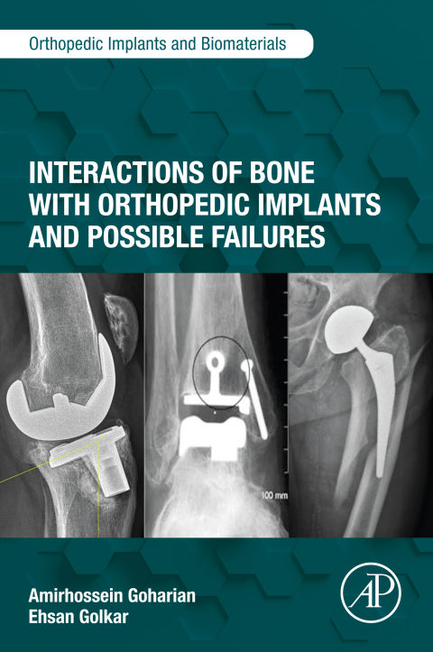 Cover image for book Interactions of Bone with Orthopedic Implants and Possible Failures