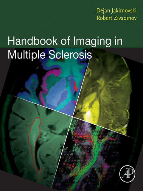 Cover image for book Handbook of Imaging in Multiple Sclerosis