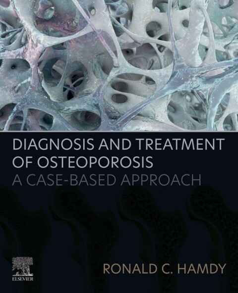 Cover image for book Diagnosis and Treatment of Osteoporosis
