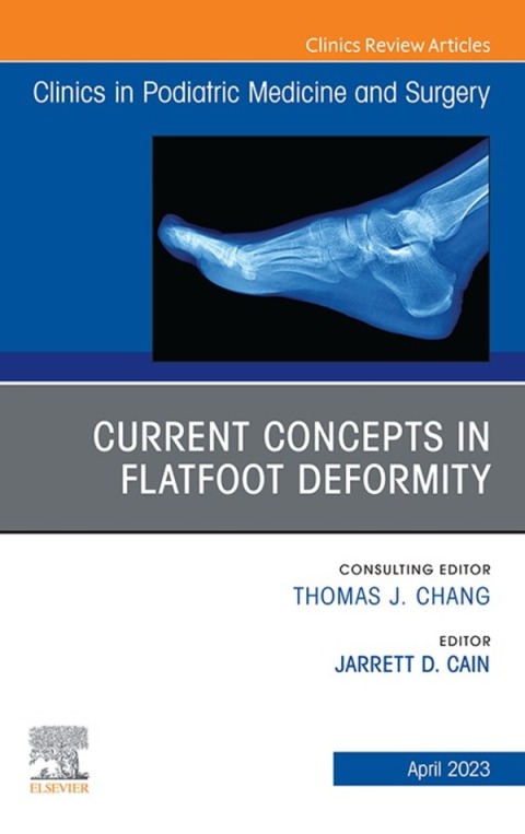 Cover image for book Current Concepts in Flatfoot Deformity , An Issue of Clinics in Podiatric Medicine and Surgery