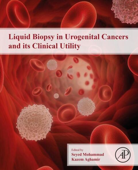 Cover image for book Liquid Biopsy in Urogenital Cancers and its Clinical Utility