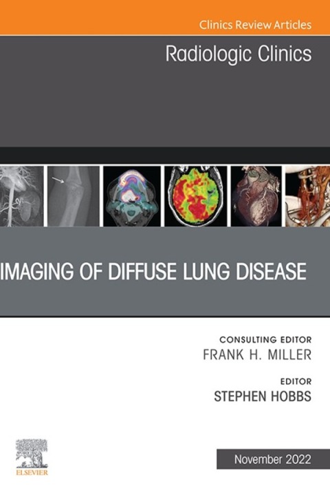 Cover image for book Imaging of Diffuse Lung Disease, An Issue of Radiologic Clinics of North America