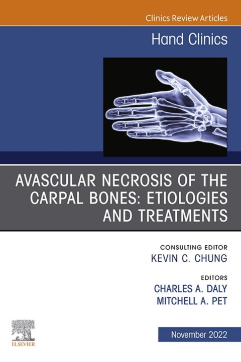 Cover image for book Avascular Necrosis of the Carpal Bones: Etiologies and Treatments, An Issue of Hand Clinics