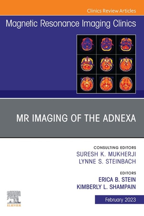 Cover image for book MR Imaging of the Adnexa, An Issue of Magnetic Resonance Imaging Clinics of North America
