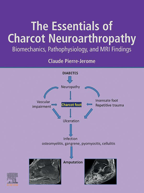 Cover image for book The Essentials of Charcot Neuroarthropathy