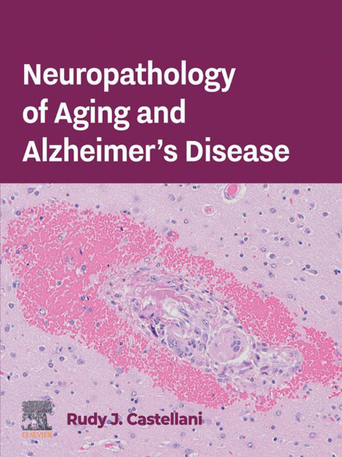 Neuropathology of Aging and Alzheimerâs Disease 