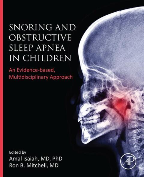 Cover image for book Snoring and Obstructive Sleep Apnea in Children