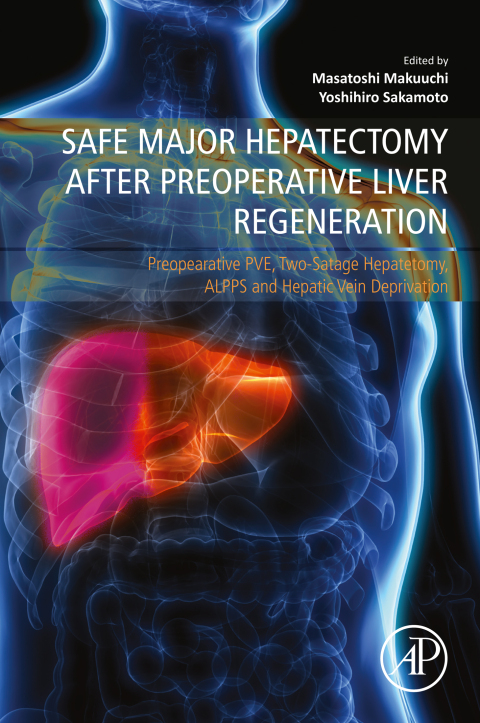 Cover image for book Safe Major Hepatectomy after Preoperative Liver Regeneration
