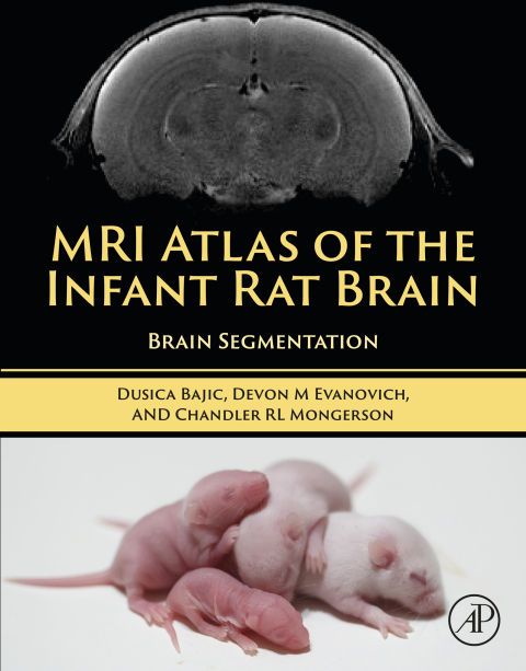 Cover image for book MRI Atlas of the Infant Rat Brain