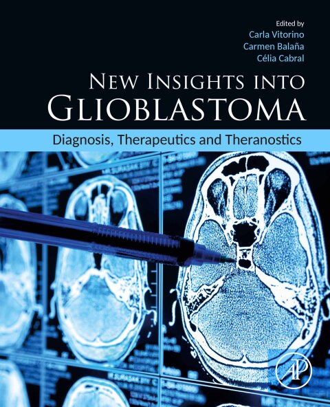 Cover image for book New Insights into Glioblastoma