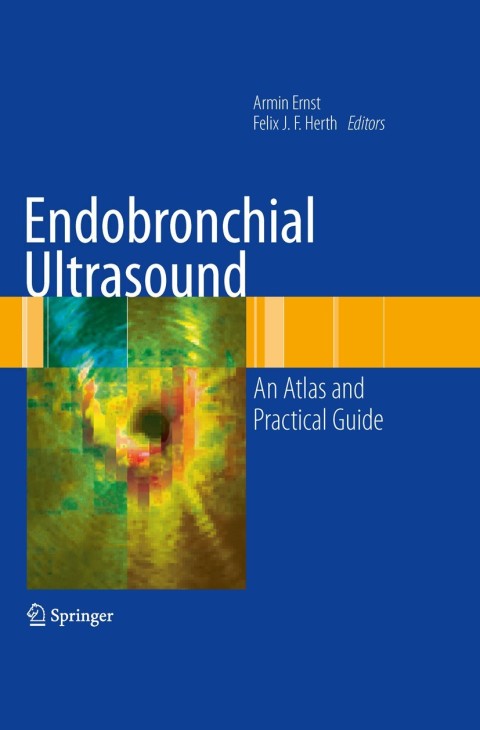 Cover image for book Endobronchial Ultrasound