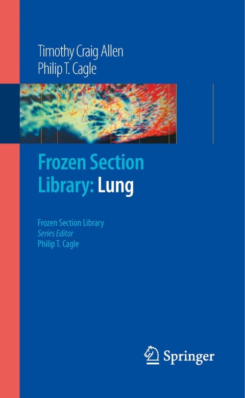 Cover image for book Frozen Section Library: Lung