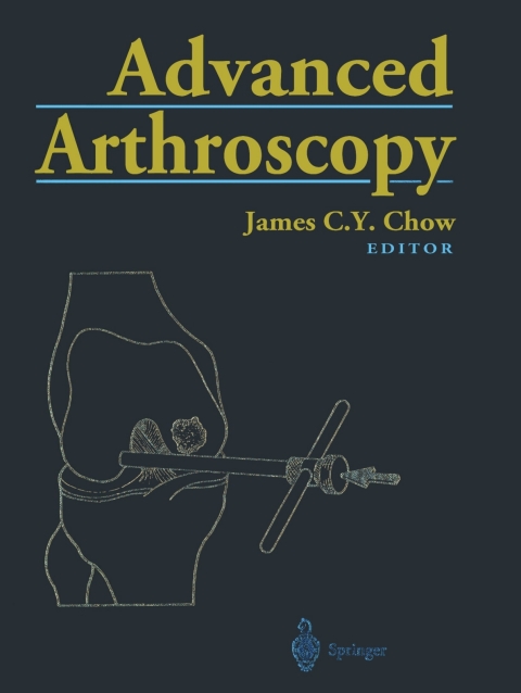 Cover image for book Advanced Arthroscopy
