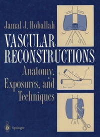 Titelbild: Vascular Reconstructions 9780387985008