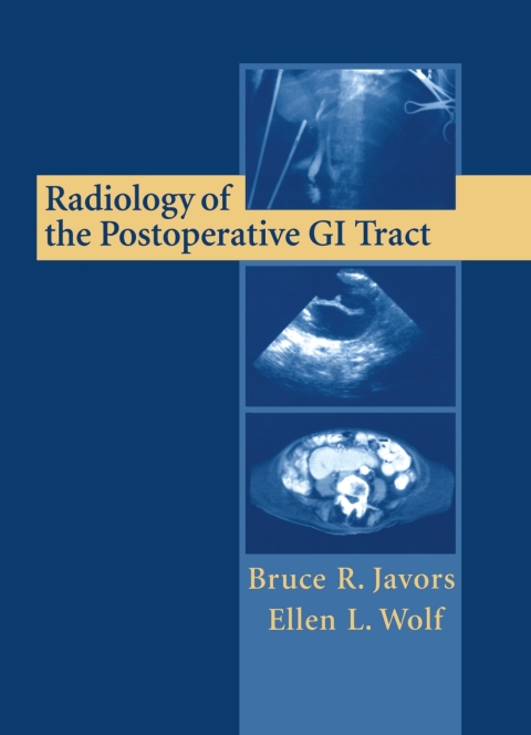 Cover image for book Radiology of the Postoperative GI Tract