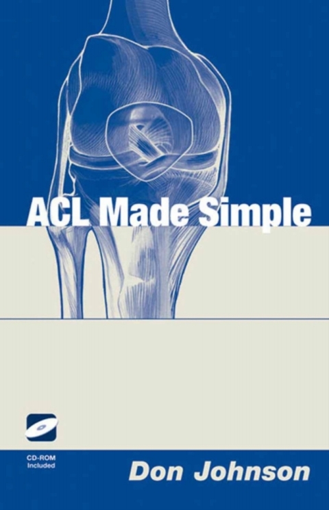 Cover image for book ACL Made Simple