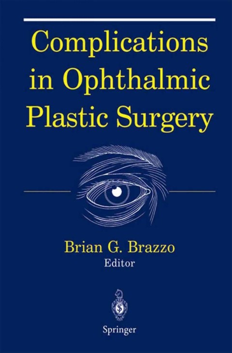 Cover image for book Complications in Ophthalmic Plastic Surgery