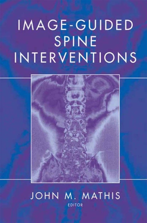 Image-Guided Spine Interventions 
