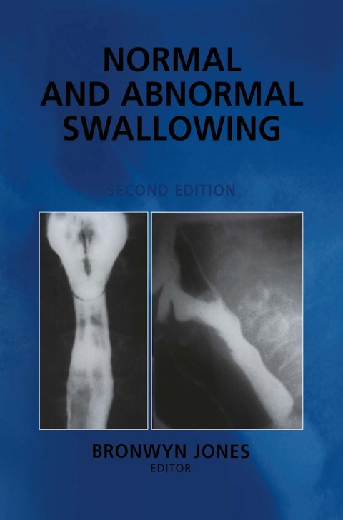 Cover image for book Normal and Abnormal Swallowing