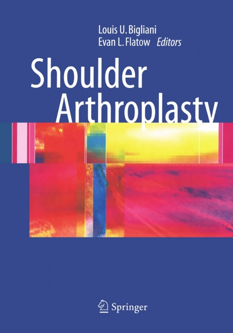 Cover image for book Shoulder Arthroplasty