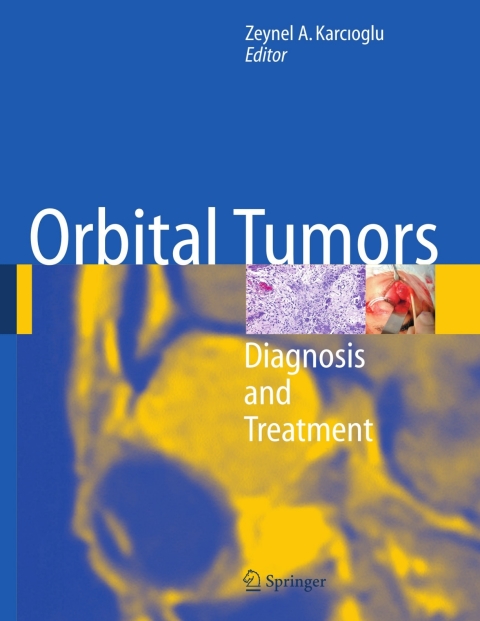 Cover image for book Orbital Tumors
