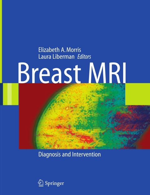 Cover image for book Breast MRI