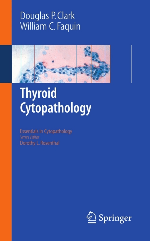 Thyroid Cytopathology 