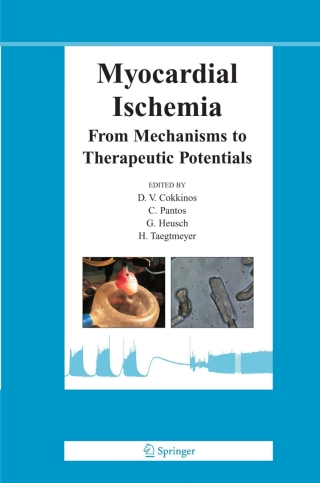 Myocardial Ischemia