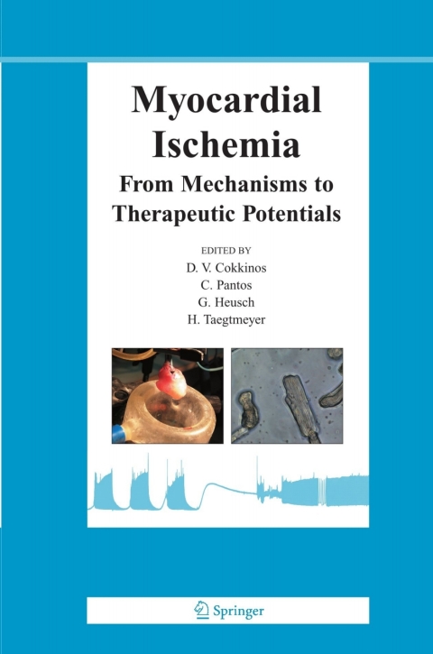 Cover image for book Myocardial Ischemia
