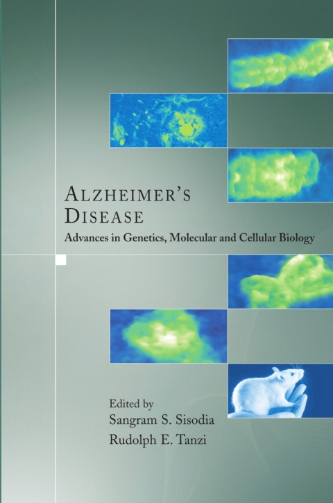 Cover image for book Alzheimer's Disease