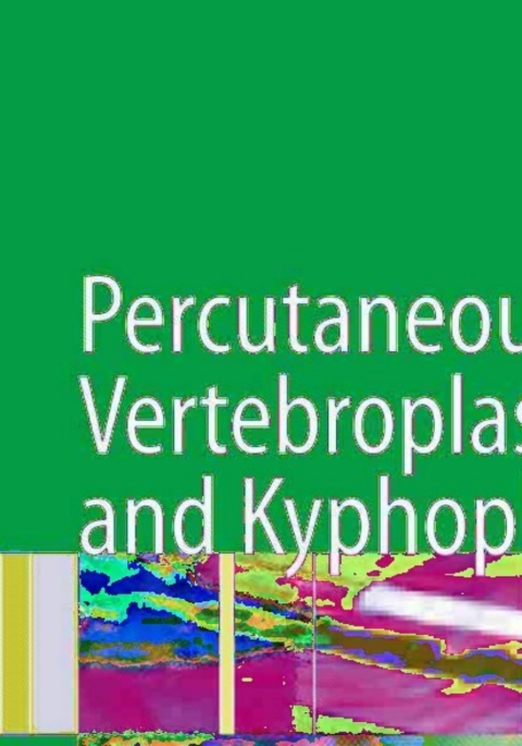 Cover image for book Percutaneous Vertebroplasty and Kyphoplasty