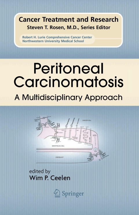 Cover image for book Peritoneal Carcinomatosis: A Multidisciplinary Approach