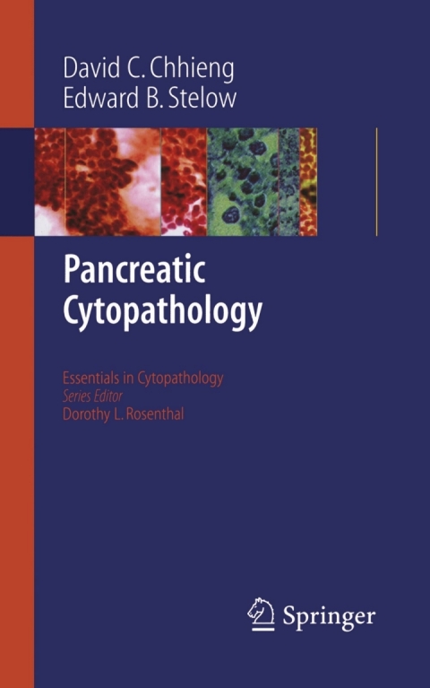 Cover image for book Pancreatic Cytopathology